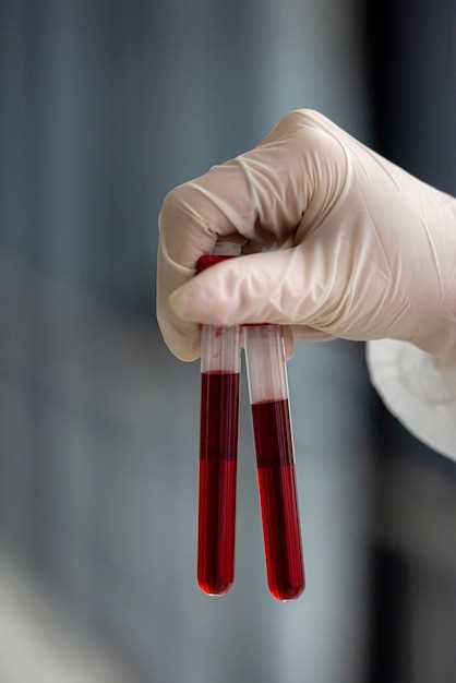 Как проводится анализ крови на тромбоз?