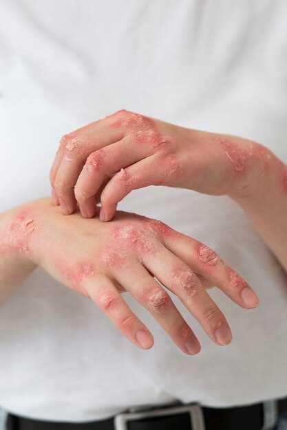 Причины возникновения аллергии