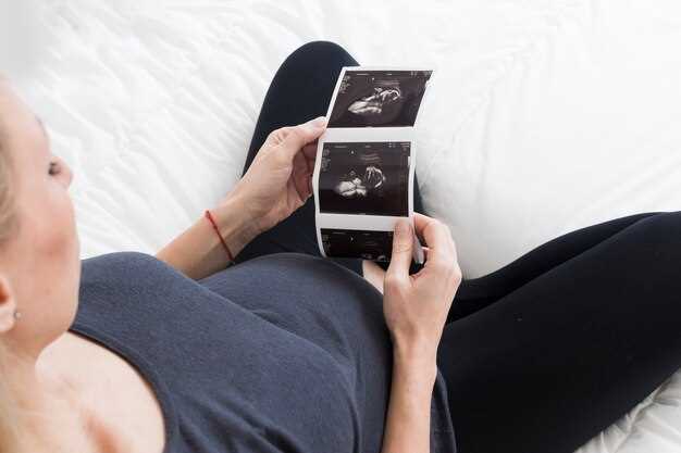Симфизит при беременности: что это и как распознать?