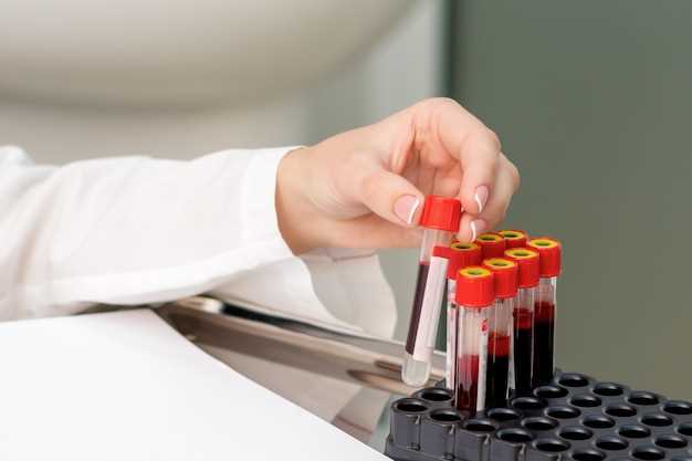 Коагулограмма расширенная: основные показатели анализа крови